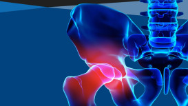 What Are The Most Popular Vitamins For Hip Pain?